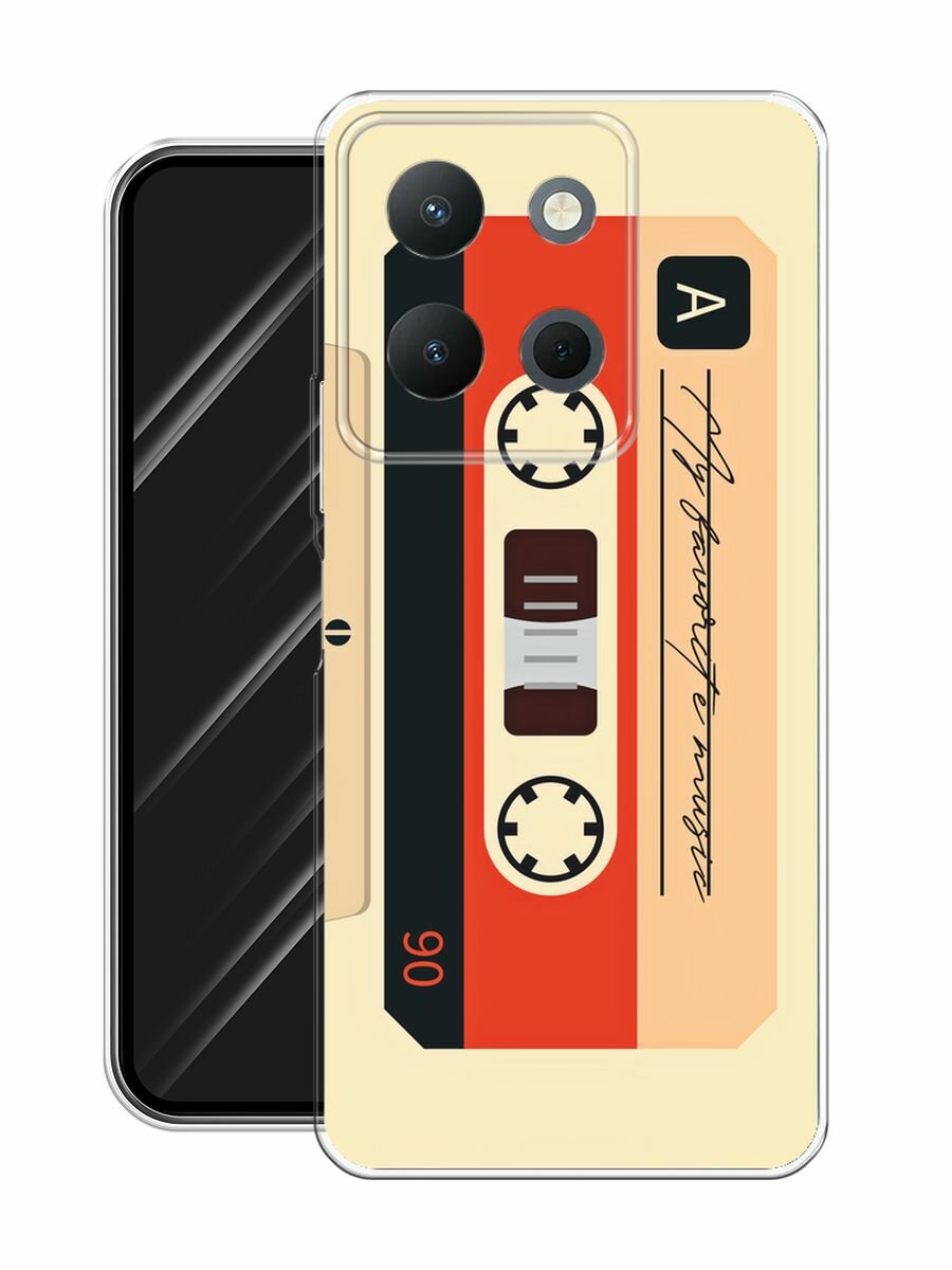 Чехол на Vivo Y36 4G / Виво Y36 4G с принтом "Бежевая кассета" — фото 1