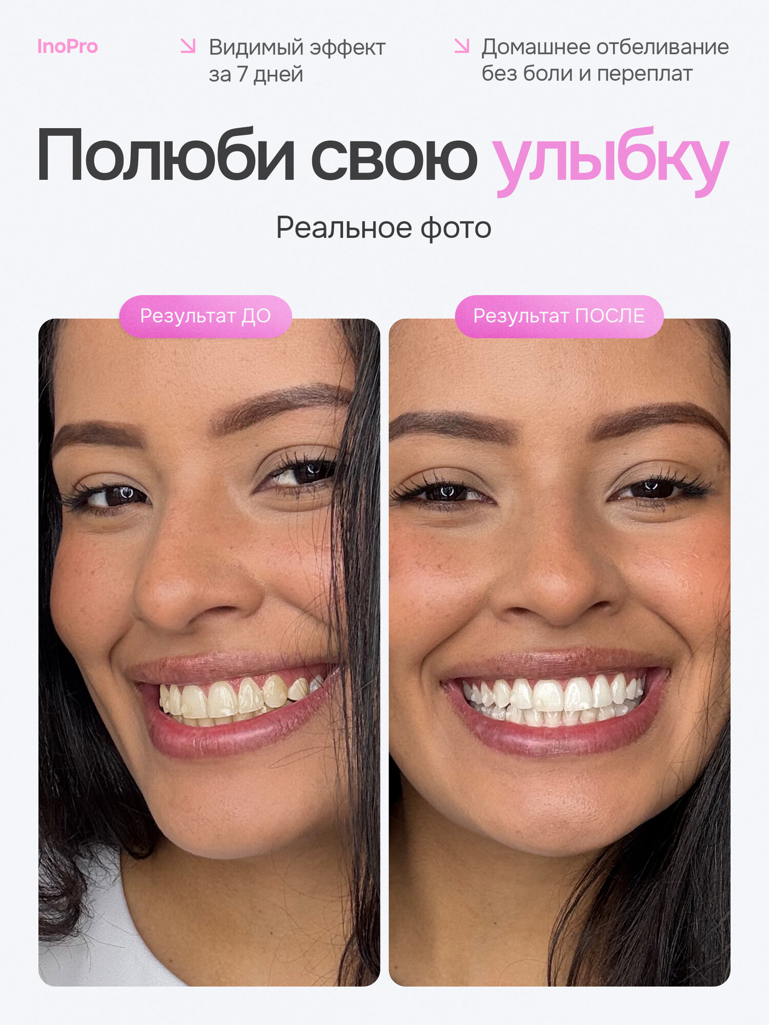 Картинки Отбеливающие полоски для зубов InoPro 42 шт безопасные без пероксида для чувствительной эмали