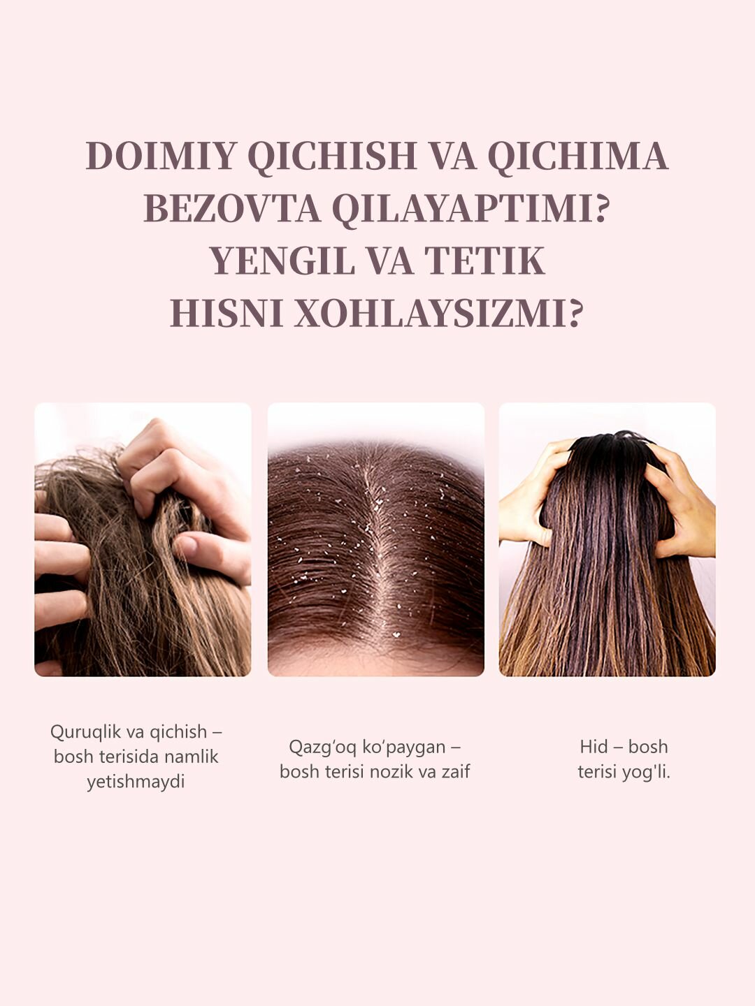 Шампунь AOGU, против перхоти, для всех типов, аромат Flower Bomb, 800мл — фото 1