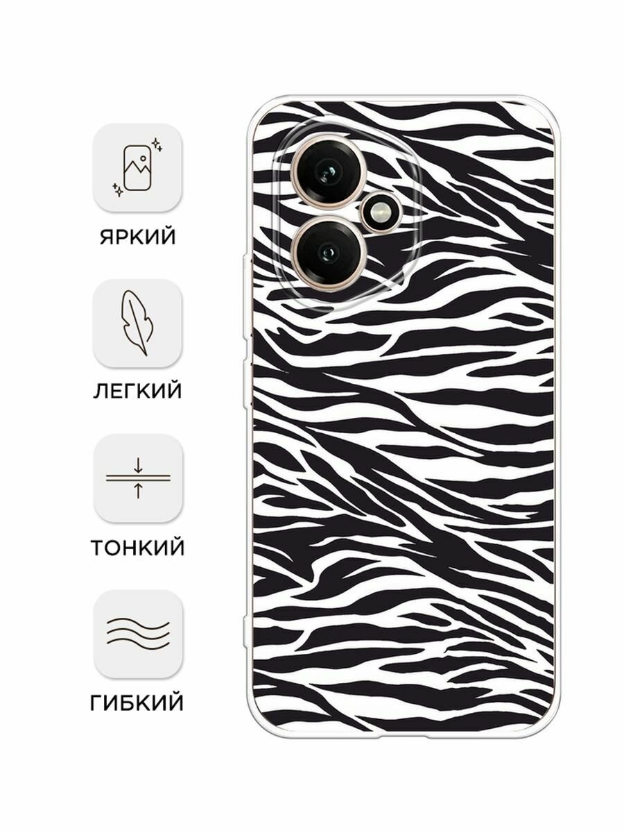 Силиконовый чехол на Honor 400 / Хонор 400 с принтом "Принт зебра" — фото 1