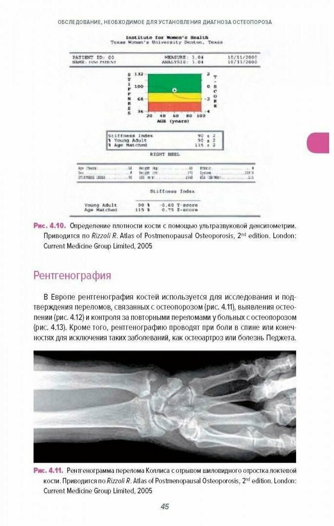 Справочник по остеопорозу (Рэйд Давид М.) - фото №4