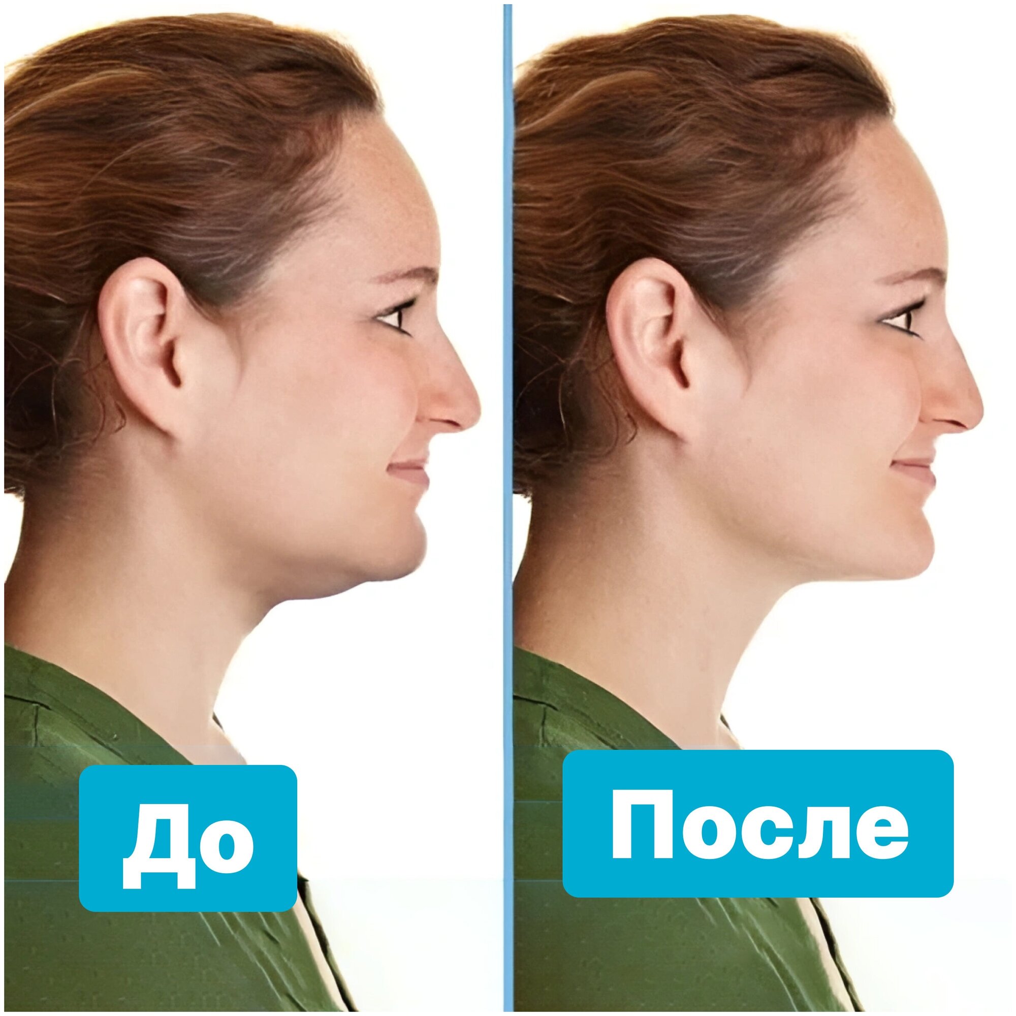 Тренажер для подбородка Neckline Slimmer (белый)