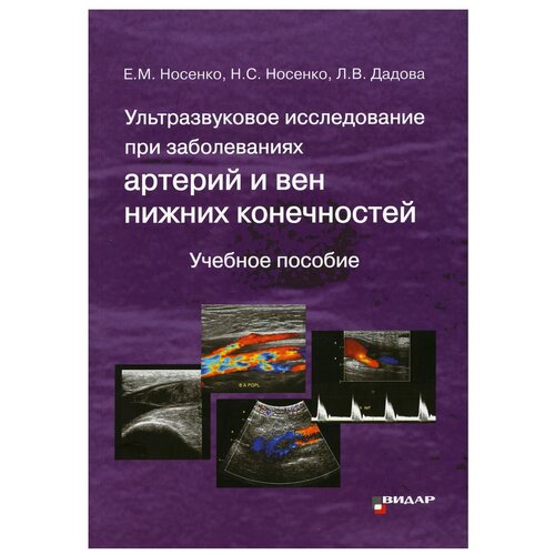 Носенко Е.М., Носенко Н.С., Дадова Л.В. "Ультразвуковое исследование при заболеваниях артерий и вен нижних конечностей."