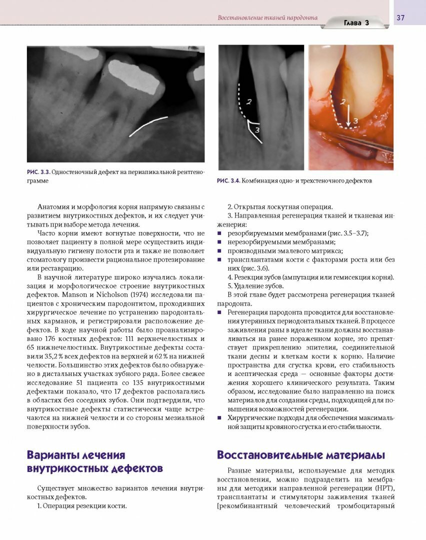 Регенеративные технологии в стоматологии. Научно-практическое руководство - фото №12