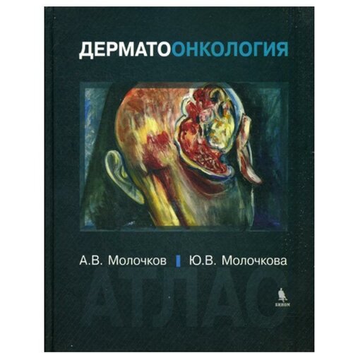 А.В. Молочков, Ю.В. Молочкова "Дерматоонкология. Атлас"