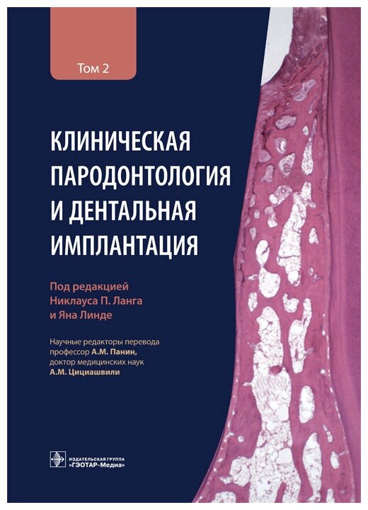 Клиническая пародонтология и дентальная имплантация : в 2 т. : Т. 2