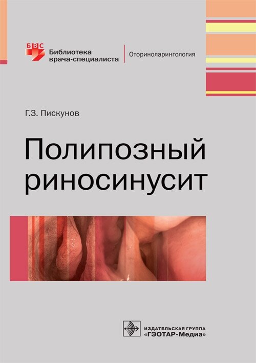 Полипозный риносинусит (Пискунов Геннадий Захарович) - фото №2