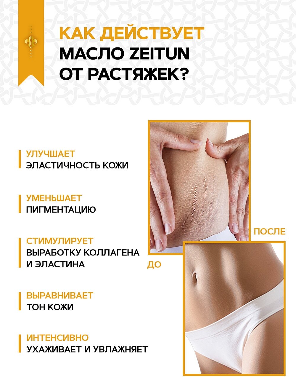 ZEITUN Масло выравнивающее для тела Zeitun Authentic от растяжек и пигментации, антицеллюлитное, 100мл