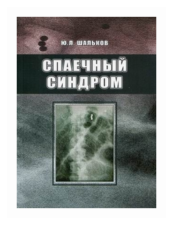 Спаечный синдром (Шальков) - фото №1