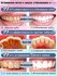 Toothpaste