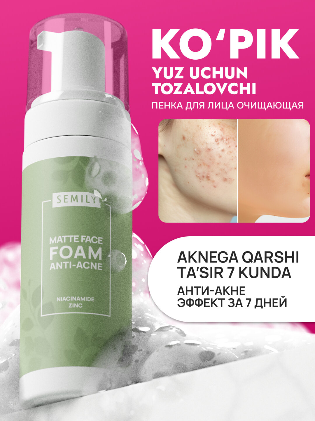 Пенка для умывания от акне, увлажняющая, SEMILY, 150 мл - Зеленый