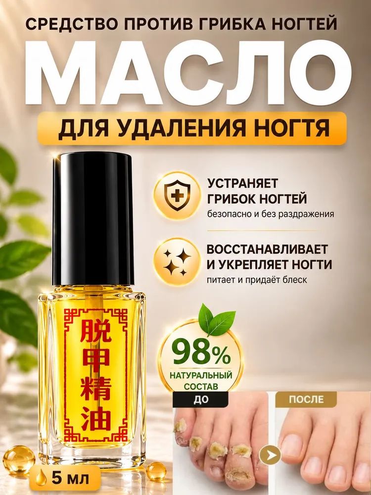 1 бутылки Средство от грибка ногтей на ногах и руках / масло от грибка ногтей, SilaVeres, 5 мл
