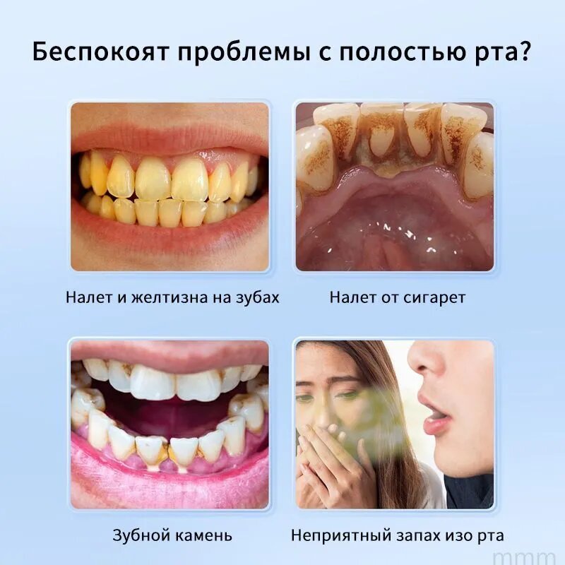 Профессиональный отбеливающий карандаш для зубов, устраняет налет от сигарет и кофе, отбеливание. Две штуки в упаковке