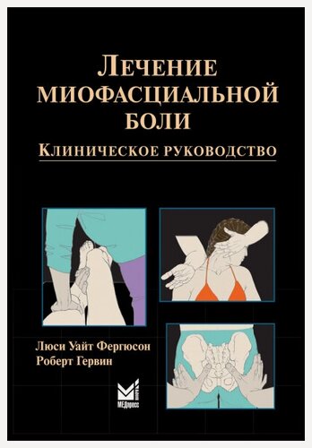 Изображение товара Лечение миофасциальной боли