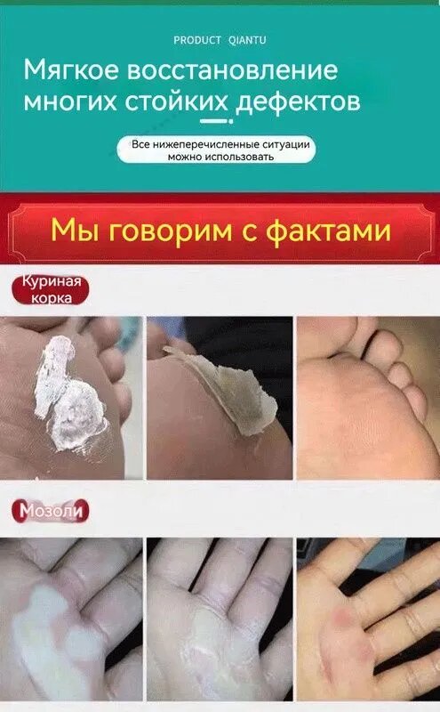 Mазь от мозолей стержневых и натоптышей , Крем от сухих мозолей, шипицы, бородавок, натоптышей,20 г 2 шт.