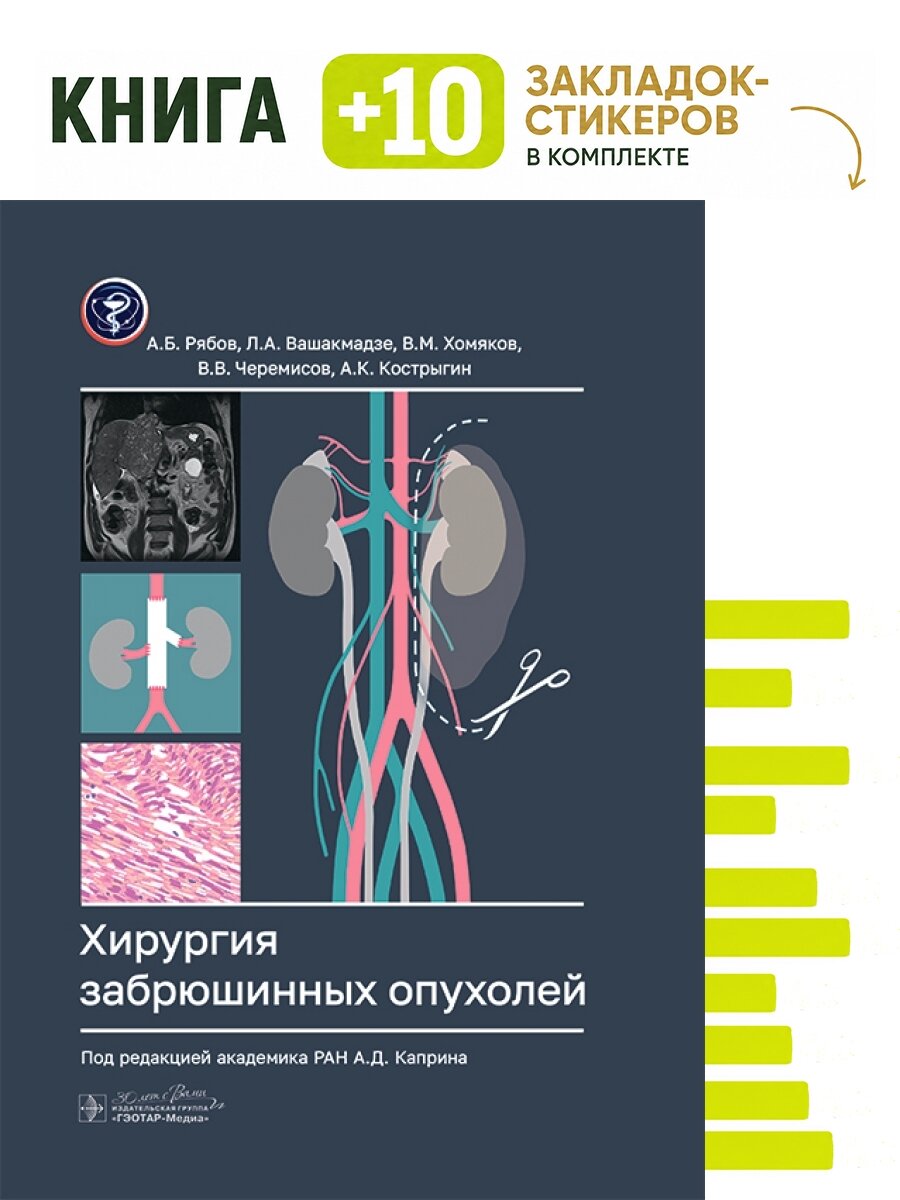 Хирургия забрюшинных опухолей. Комплект: книга + 10 закладок-стикеров