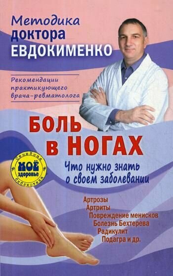 Боль в ногах. Что нужно знать о своем заболевании. 4-е изд, перераб. Евдокименко П. В.