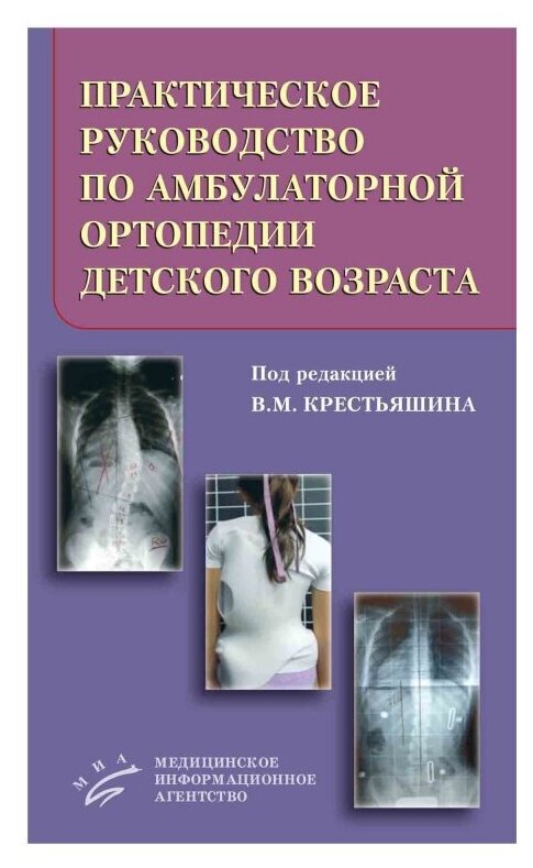 Практическое руководство по амбулаторной ортопедии детского возраста