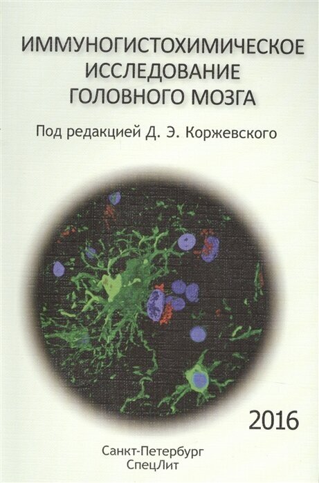 Иммуногистохимическое исследование головного мозга - фото №1