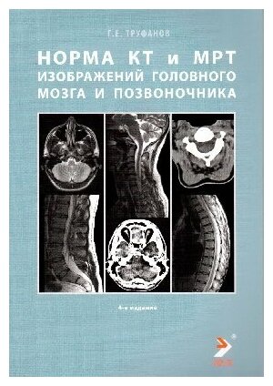 Труфанов Г. Е. "Норма КТ и МРТ изображений головного мозга и позвоночника. Руководство для врачей.- 4-е изд"