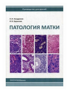 Патология матки. Руководство для врачей - фото №1