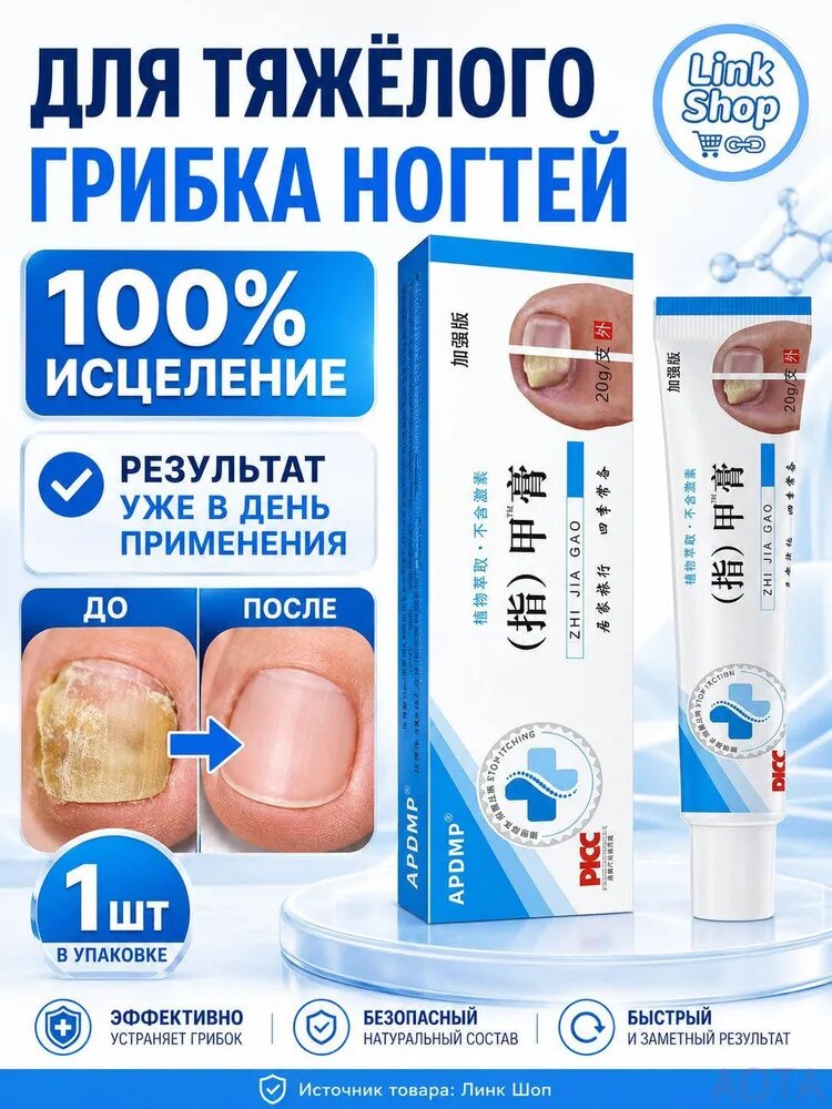 Крем ноготок от грибка ногтей на ногах, ноготок мазь от грибка на ногах, гиперкератоз 1 штуки
