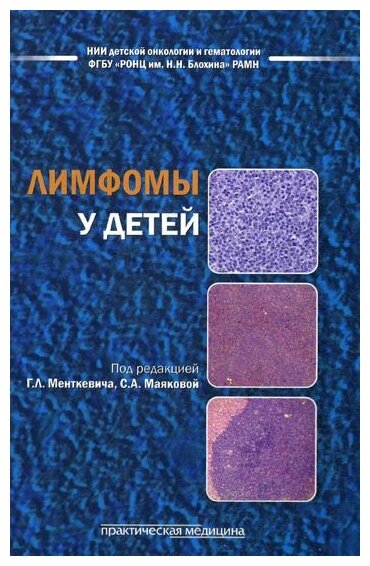 Лимфомы у детей (Менткевич Георгий Людомирович, Маякова Светлана Александровна, Барышников А. Ю.) - фото №1