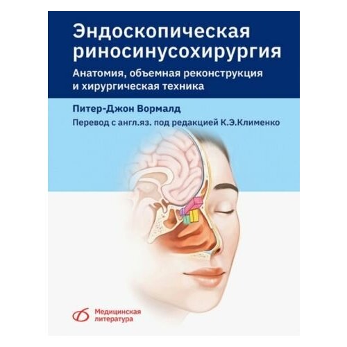 Питер-джон вормалд: эндоскопическая риносинусохирургия. анатомия, объемная реконструкция и хирургическая техника