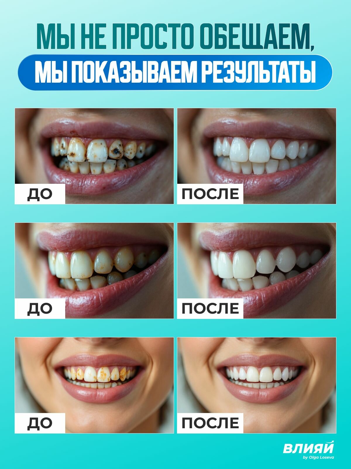 Карандаш для отбеливания зубов