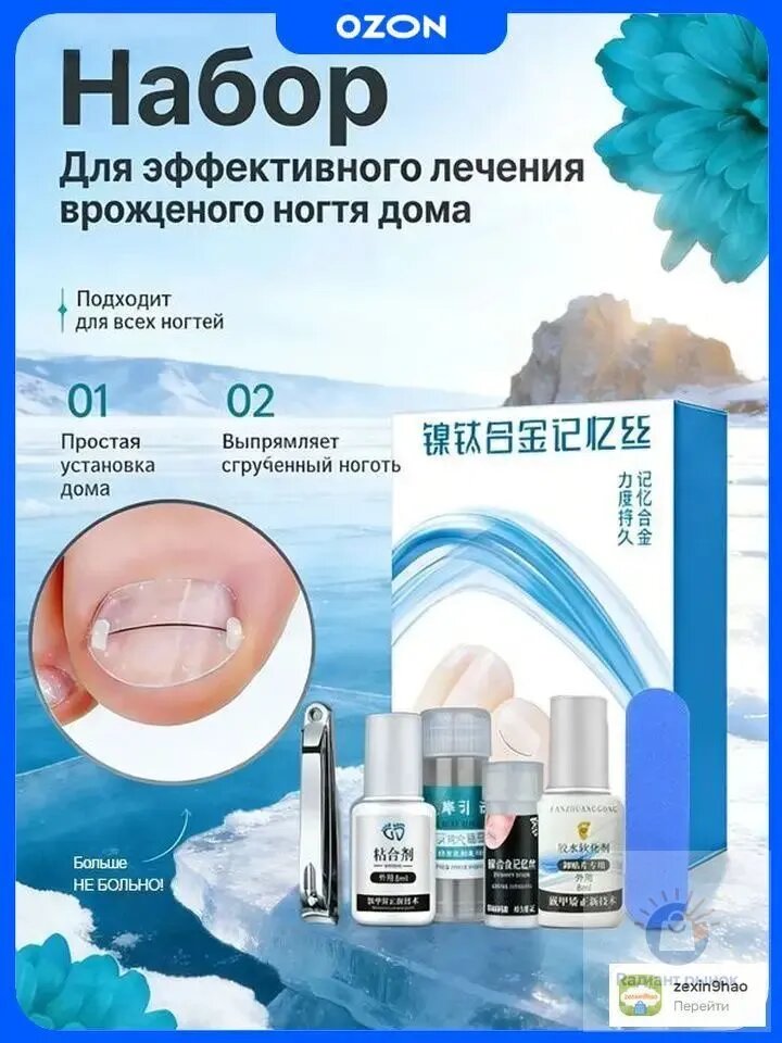 Bросших ногтей Комплект из 15 никелид-титановых корректоров для вросших ногтей