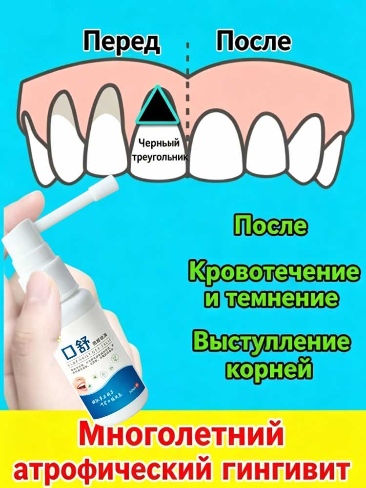 Спрей от зубной боли на 1 секунду для облегчения боли, быстро снимает зубную боль, отек десен и боль от кариеса, портативная упаковка объемом 30 мл