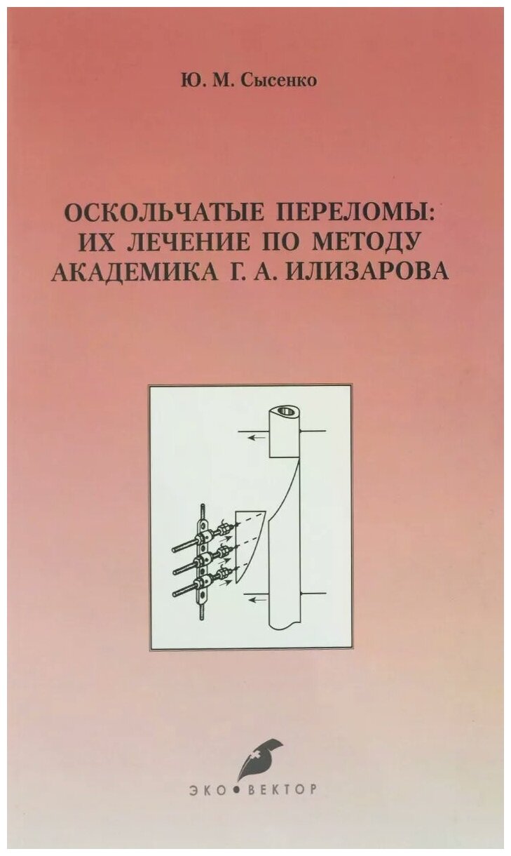 Оскольчатые переломы. Их лечение по методу академика Г. А. Илизарова. Монография - фото №1