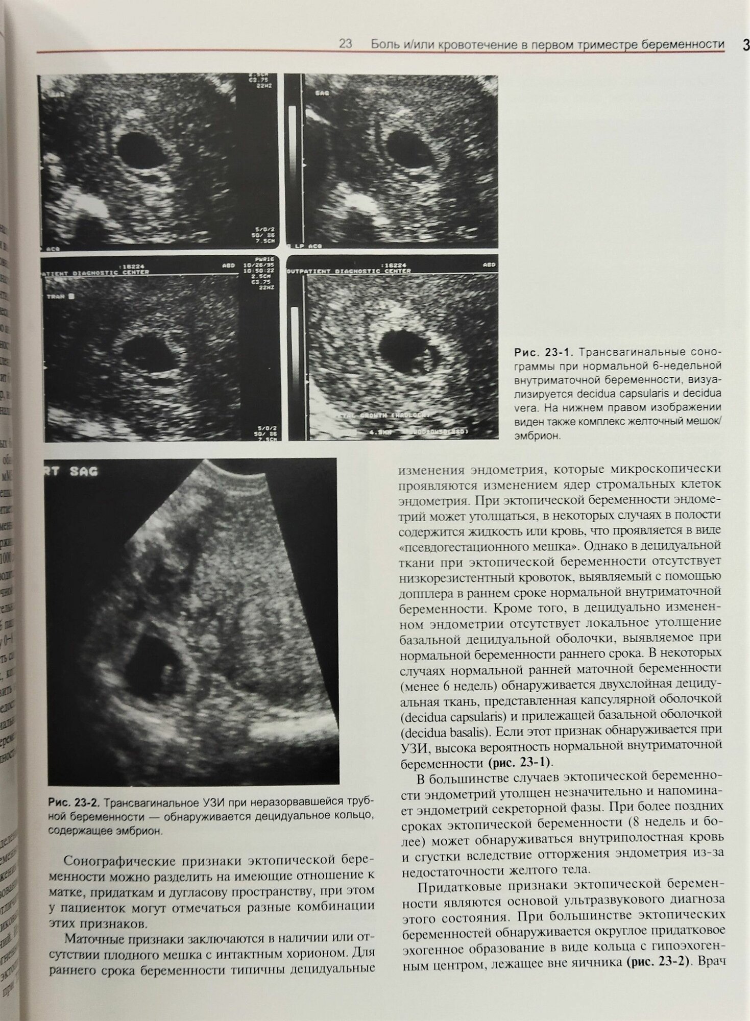 Ультразвуковая диагностика. Практическое решение клинических проблем. Том 3. УЗИ в акушерстве - фото №6