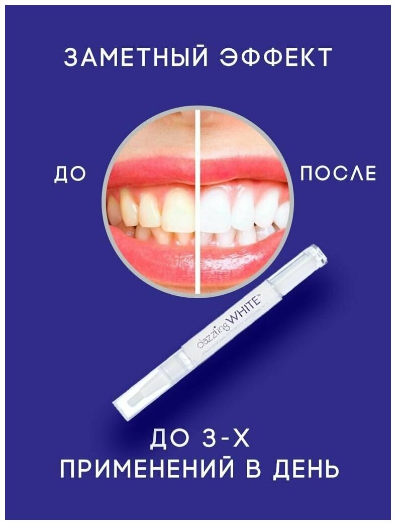 Отбеливающий карандаш для зубов, Отбеливание зубов