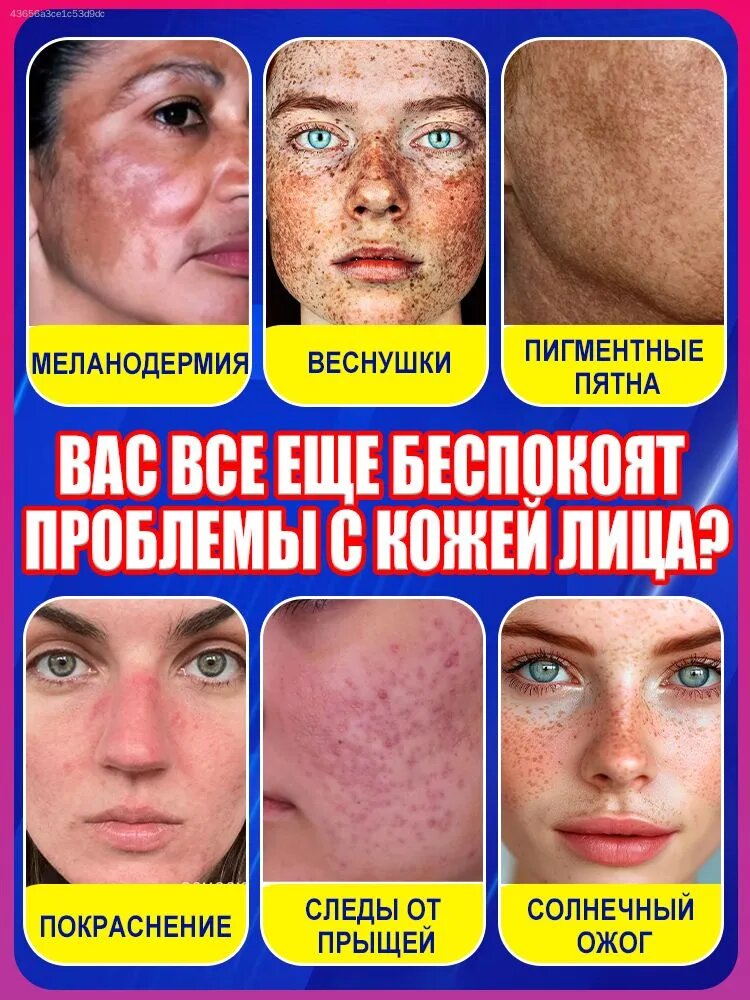 Гипоаллергенный осветляющий крем от пигментных пятен с ниацинамидом и витамином С выравнивает тон, убирает постакне и веснушки, увлажняет и защищает. Для чувствительной кожи.