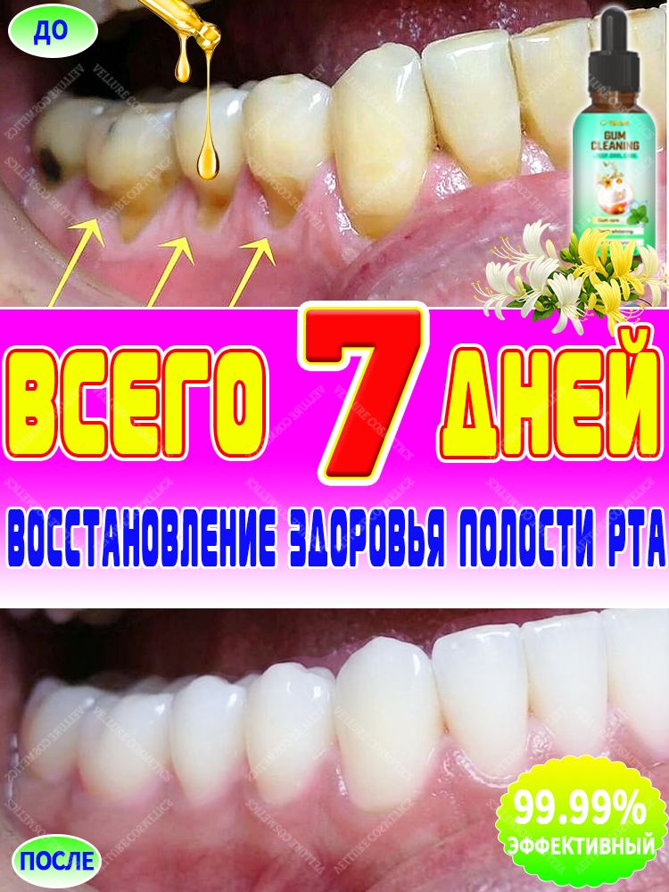 Средства для лечения заболеваний пародонта и кровоточивости десен. Снимает покраснения и отеки, отбеливает и укрепляет зубы, обладает антибактериальными свойствами и освежает дыхание. 30 мл