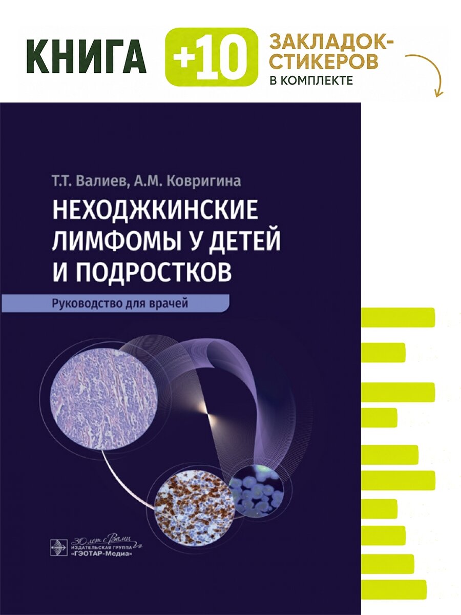 Неходжкинские лимфомы у детей и подростков : руководство для врачей. Комплект: книга + 10 закладок-стикеров