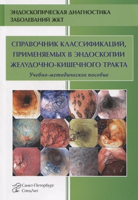 Справочник классификаций, применяемых в эндоскопии желудочно-кишечного тракта - фото №2