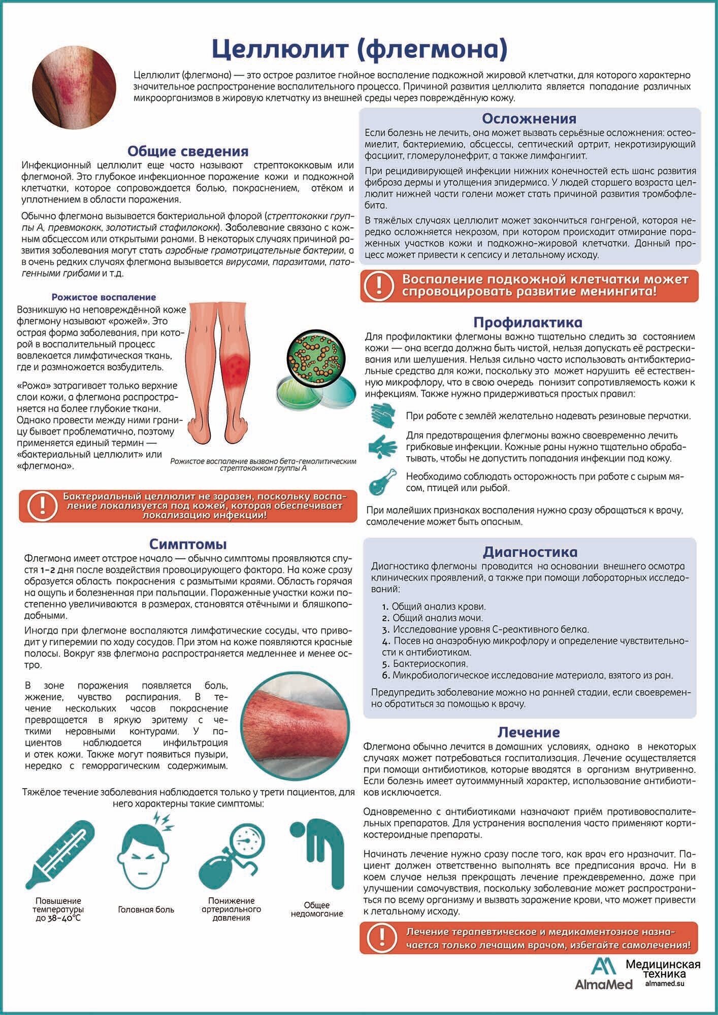Целлюлит (флегома) медицинский плакат глянцевая фотобумага от 200 г/кв. м, размер A1+