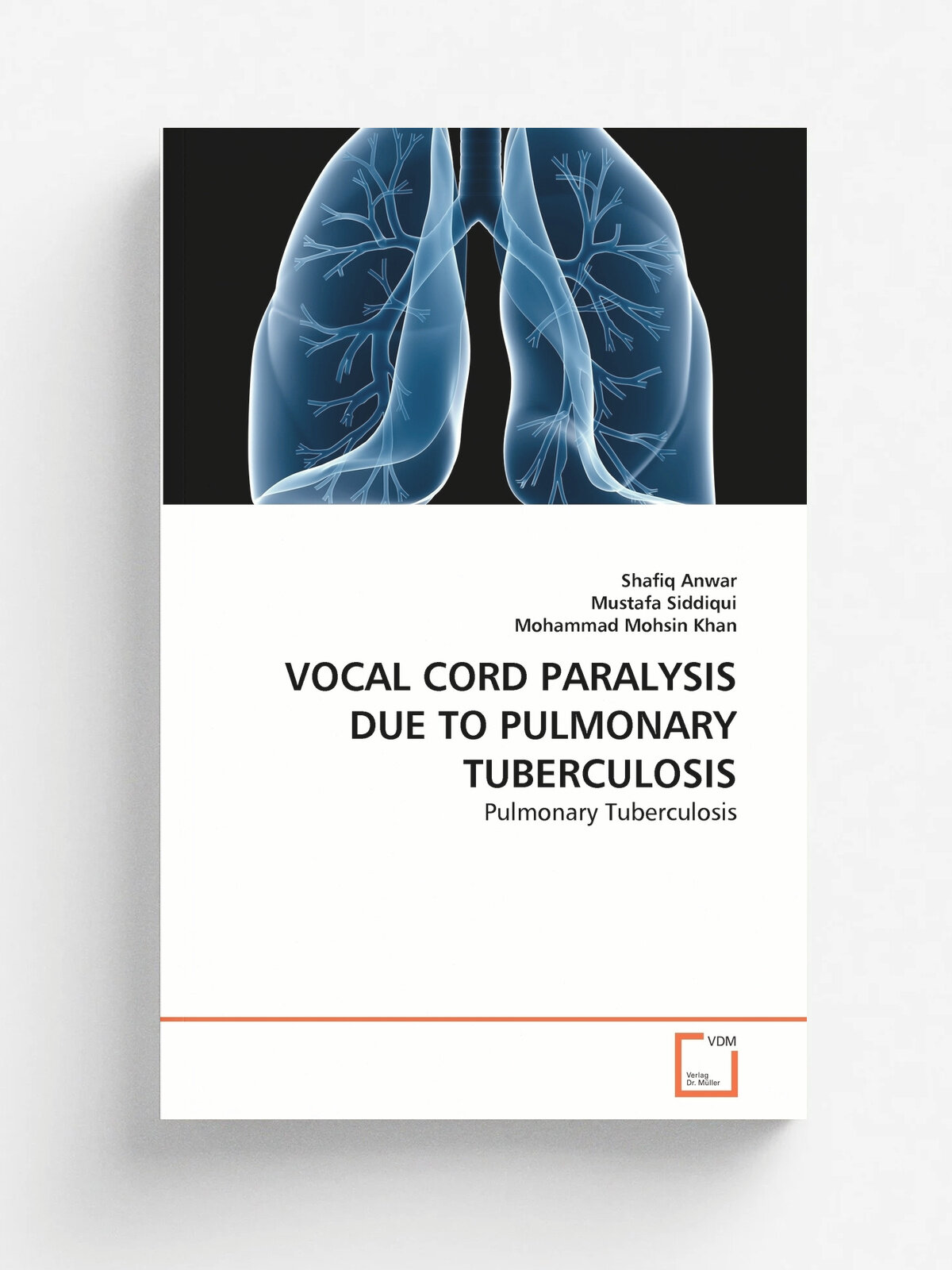 Vocal Cord Paralysis Due To Pulmonary Tuberculosis | Shafiq Anwar | KS OmniScriptum Publishing, 2011 | Английский язык