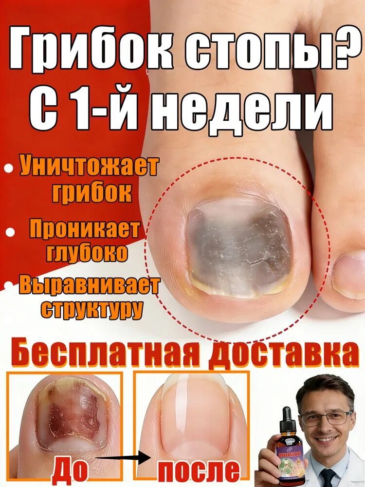 Спрей от грибка ногтей: лечит онихолизис, устраняет неприятный запах и зуд. Восстанавливает цвет и структуру ногтя. Глубокое проникновение. 10 мл