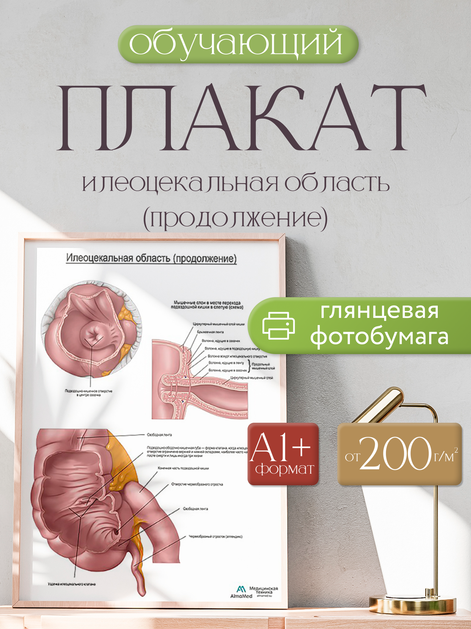 Обучающий плакат "Подвздошно-слепокишечная область, продолжение", размер А1+, глянцевая фотобумага от 200г/м2