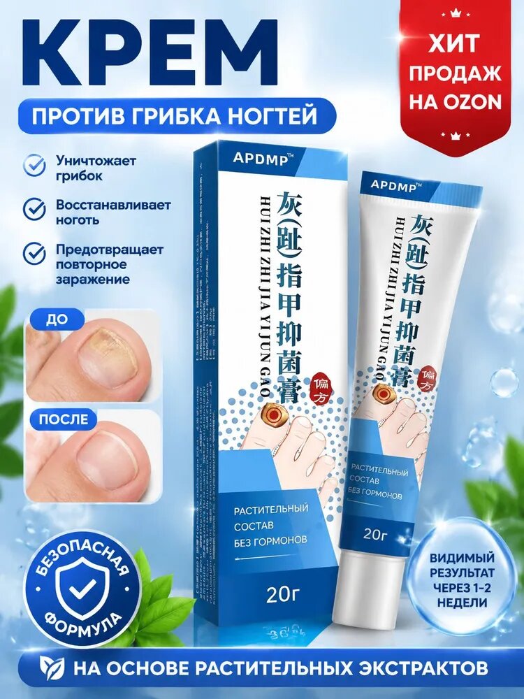 3 штуки, крем ноготок от грибка ногтей на ногах, гиперкератоз