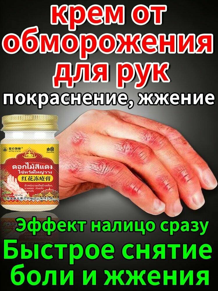 Мазь для лечения и защиты рук и ног от обморожений, 50 г