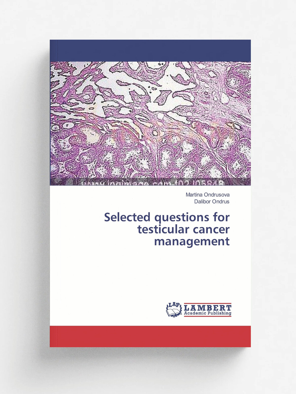 Selected questions for testicular cancer management