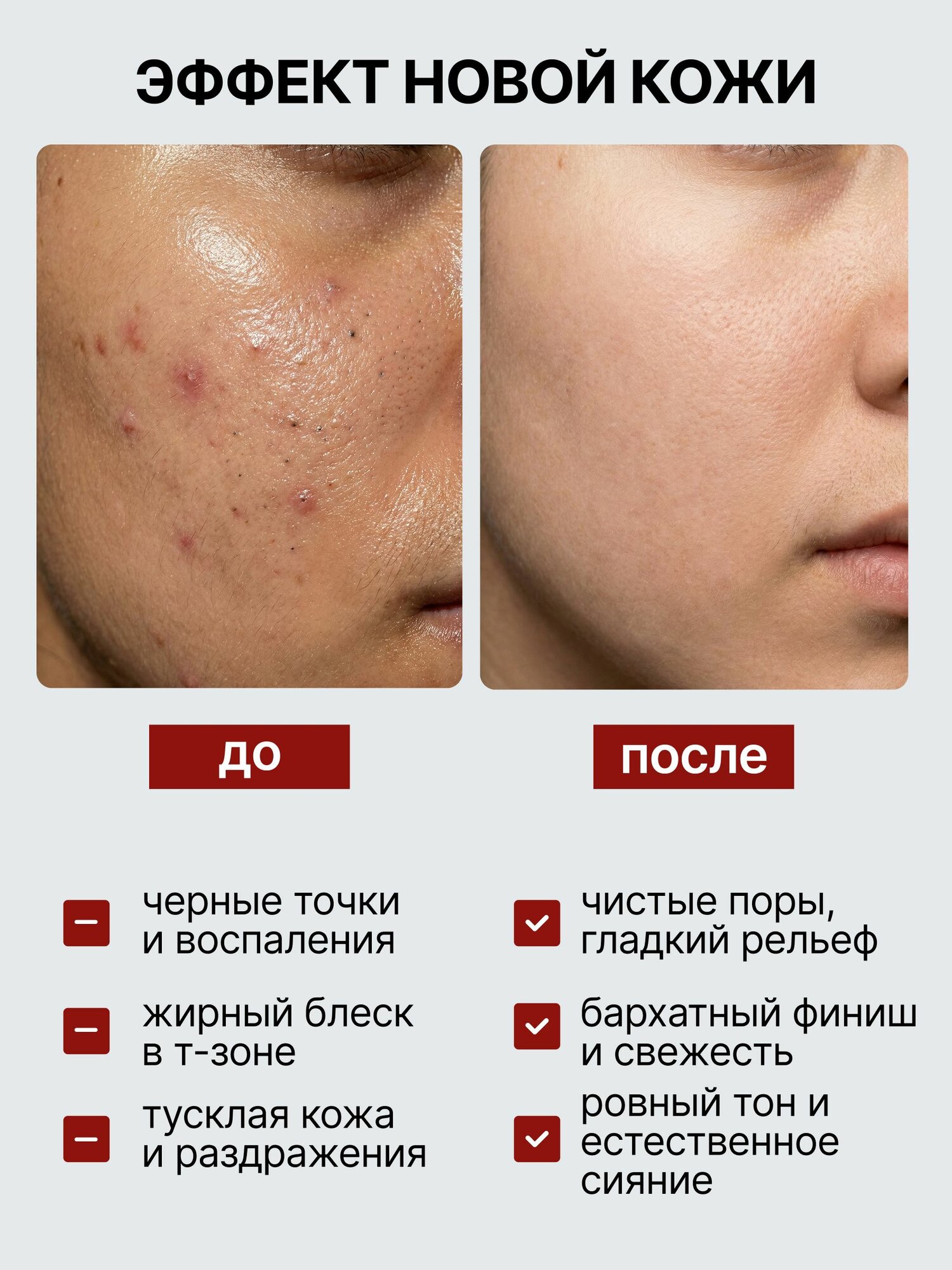 Тоник с гликолевой кислотой, лосьон для лица от прыщей
