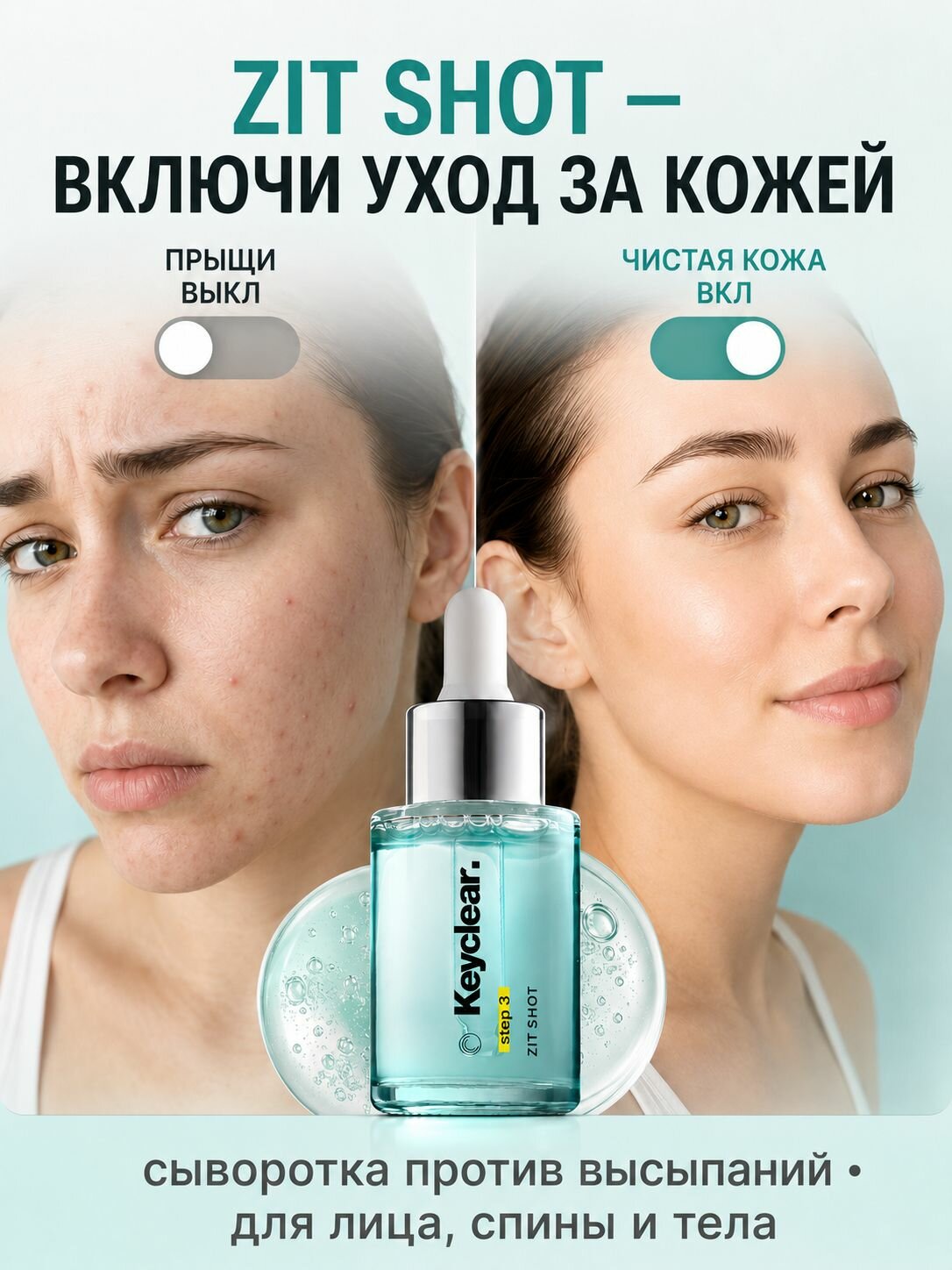 Сыворотка с ниацинамидом от прыщей и черных точек