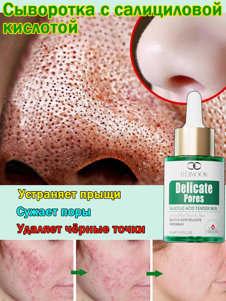 Сыворотка для лица с салициловой кислотой 30 мл, для кожи, склонной к акне, oт черных точек, уменьшает поры, безупречная кожа