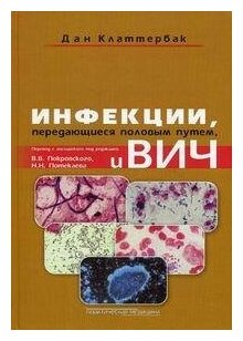 Инфекции, передающиеся половым путем, и ВИЧ-инфекция