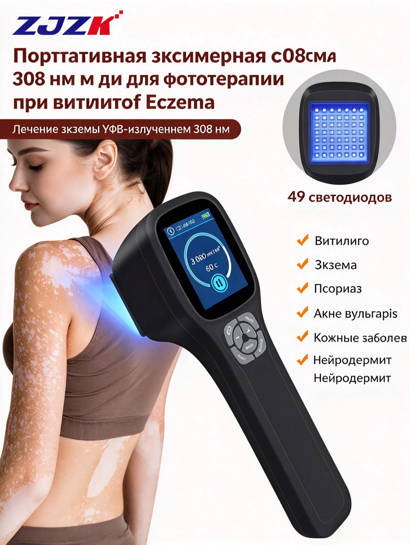 ZJZK лампа УФ UVB 308 нм фототерапии от атопического дерматита устраняет кожные папулы